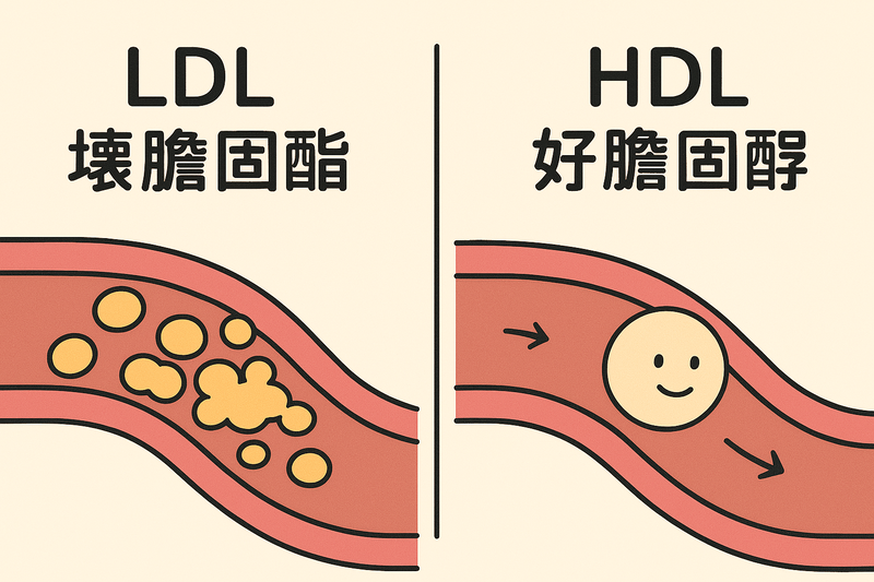 LDL